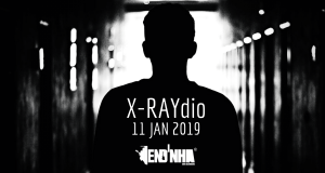 X-RAYdio